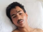 Kesaksian Fadli Selamat dari Erupsi Gunung Marapi, Terkena Hujan Batu Panas hingga Hampir Kehilangan Jari